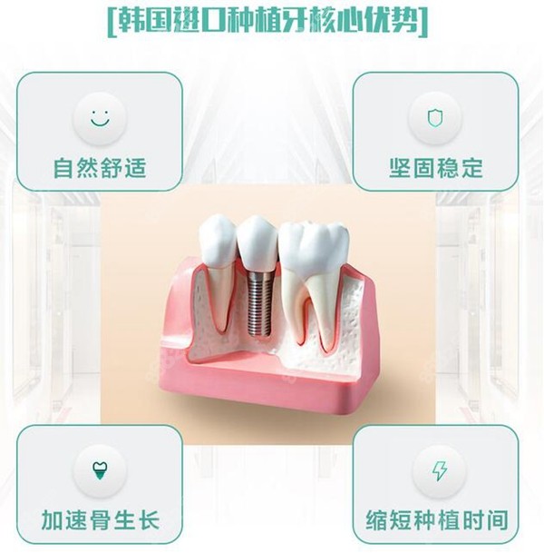 韩国登腾种植牙介绍