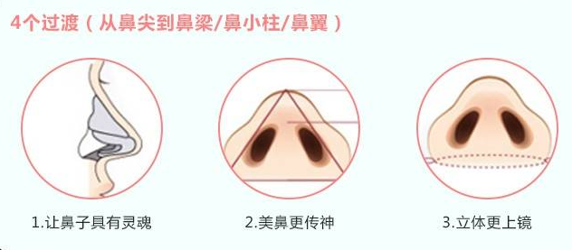 隆鼻失败可在北京沃尔做鼻修复