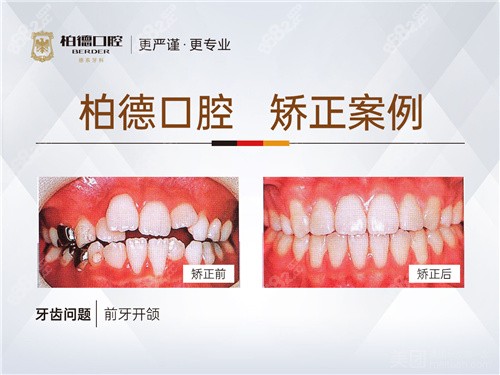 昆明柏德口腔牙齿矫正<span style=