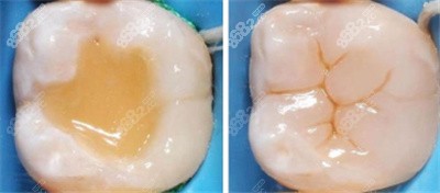 平湖舒益口腔补牙<span style=
