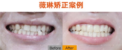 宁波薇琳口腔正畸<span style=