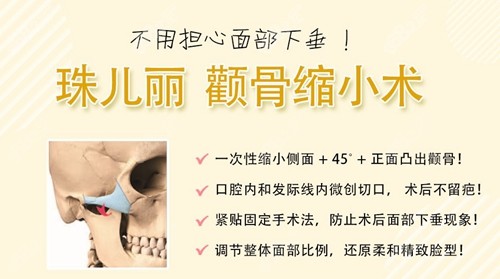 韩国珠儿丽颧骨缩小优势
