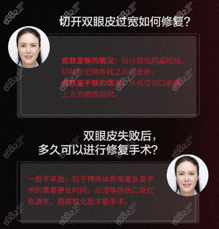 <!--<i data=20240705-sp></i>-->利大师眼修复对话