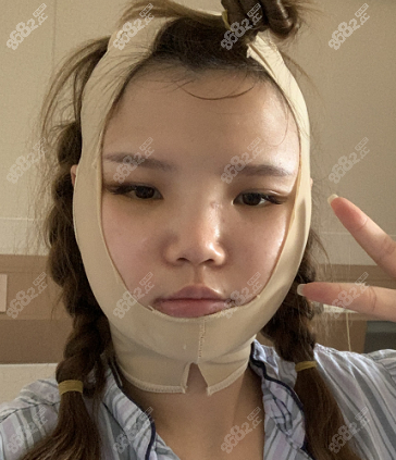 第三天