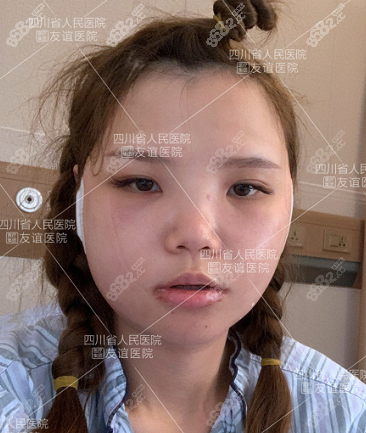 刚做完手术的样子