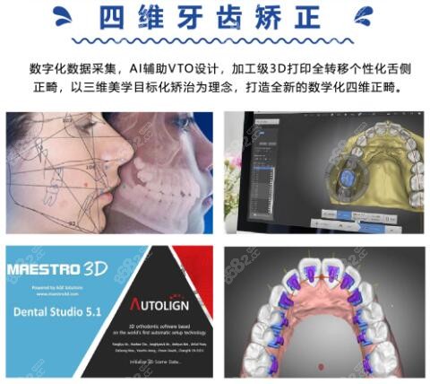 <!--<i data=20240705-sp></i>-->口腔门诊牙齿矫正优势