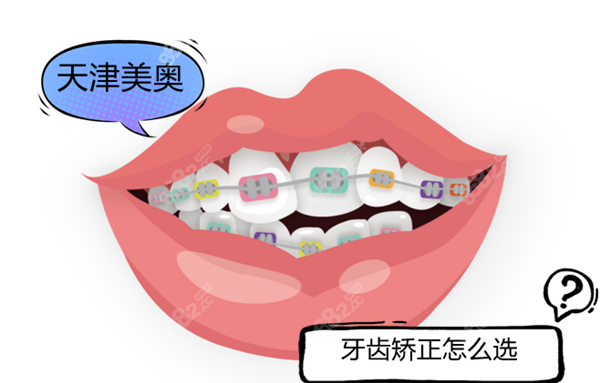 天津美奥牙齿矫正