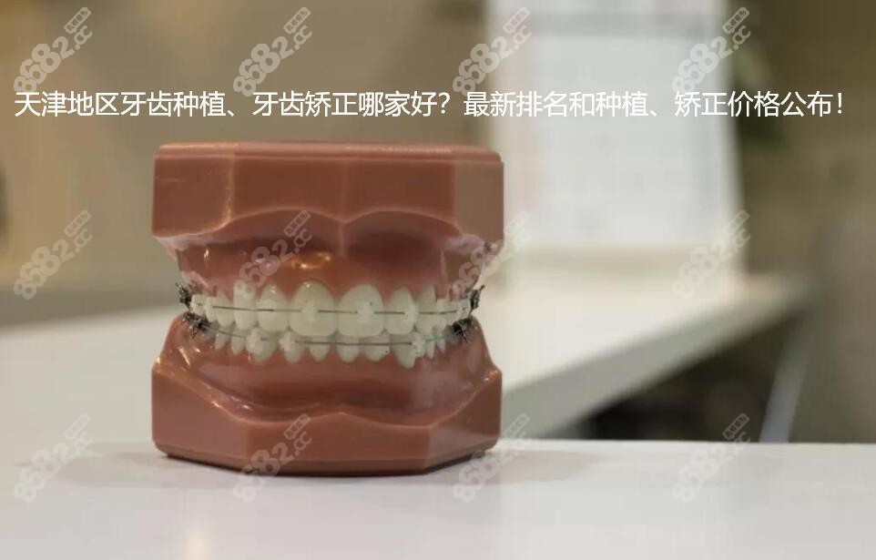 天津种植矫正口碑排行