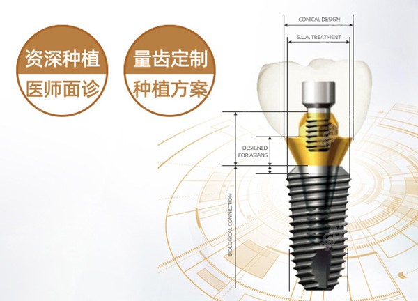 量齒定制種植方案 量齒定制種植方案