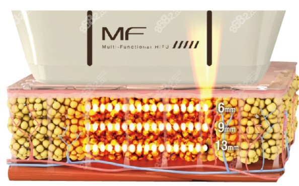 7D聚拉具体操作原理演示