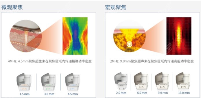 7D聚拉提MAX的独特之处，在于它“分层抗衰”的理念