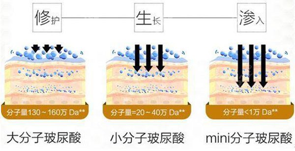 玻尿酸在填充到面部是的层次和效果