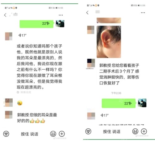 <!--<i data=20240705-sp></i>-->院长做小耳再造的反馈