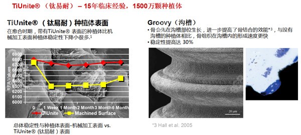 瑞典诺贝尔种植体的优势特点