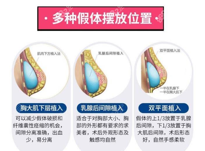 乳房重建需要多少钱图片