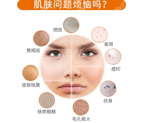 你的肌肤有这些烦恼吗？在上海做祛斑多少钱？