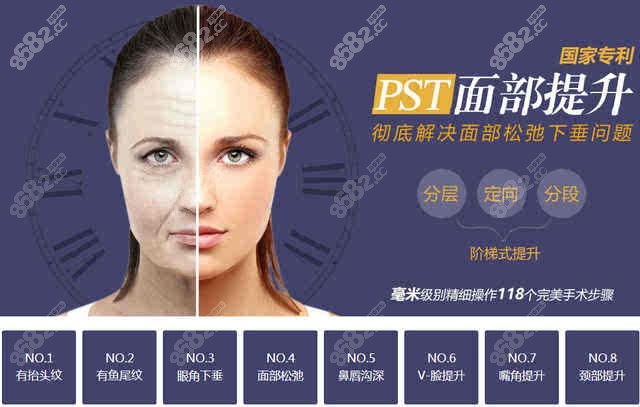 PST面部提升优势