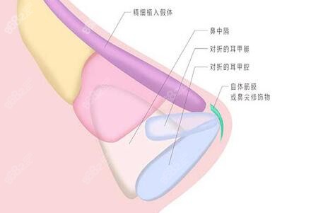 <!--<i data=20240705-sp></i>-->做鼻综合优势