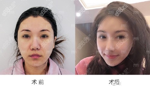 <!--<i data=20240705-sp></i>-->瑞丽李晓东pst效果图