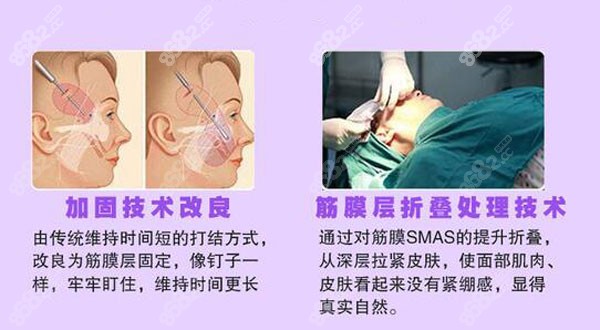 宋天成医生做拉皮手术的优势