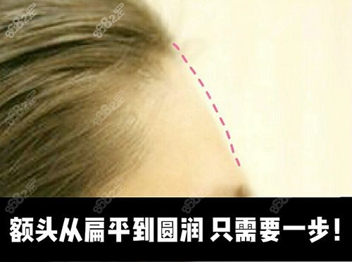 扁平的额头