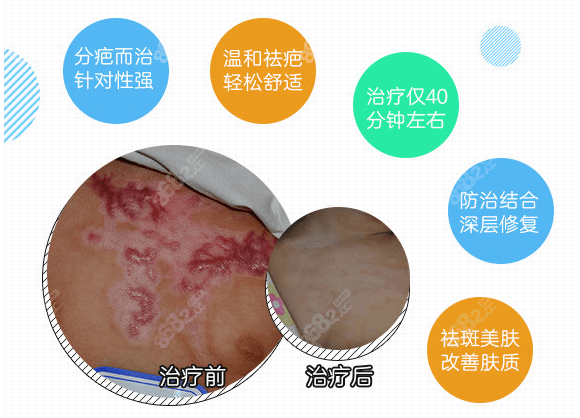 北京国丹医院疤痕修复有方法