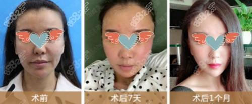 北京加减美v6提升真人效果前后对比图