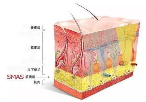拉皮手术提升的层面