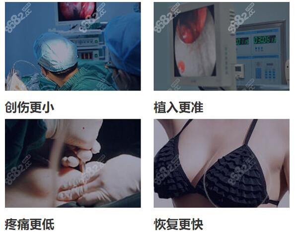 汪灏院长提出采用内窥镜方式进行丰胸手术