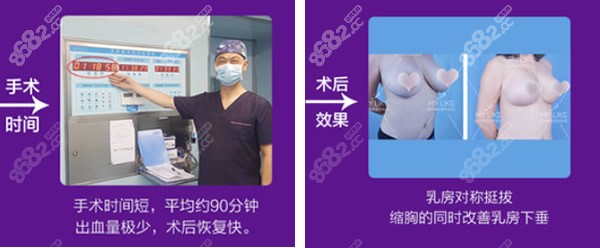 栗勇医生缩胸手术效果图