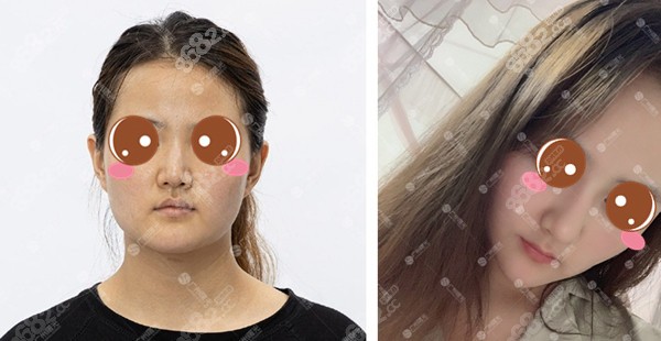 广州做鼻子美容整形（广州哪个美容医生做鼻子好） 广州做鼻子美容整形（广州哪个美容大夫
做鼻子好）《广州哪个美容医生做鼻子好》 整形美容