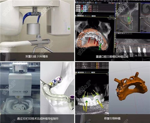 <!--<i data=20240705-sp></i>-->海宁分院数字化种植牙