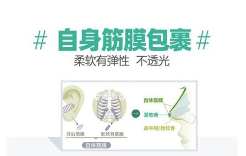 自体筋膜包裹软骨的原理