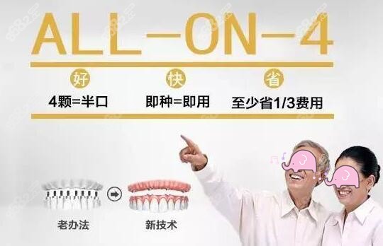all-on-4种植技术的优势体现