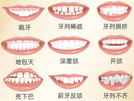 常见存在的牙齿问题