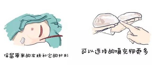 西安國(guó) 際乳房再造手術(shù)
