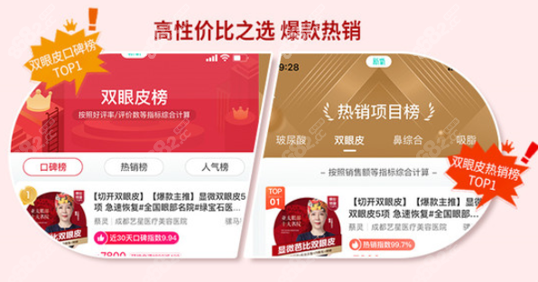 成都艺星做双眼皮的口碑好