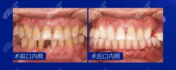 这是美奥口腔种植牙<span style=