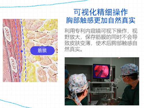 <!--<i data=20240705-sp></i>-->隆胸技术优势