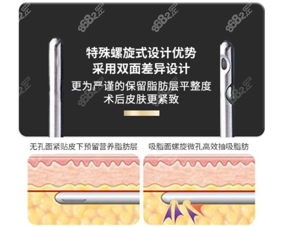 张让虎院长在抽脂手术中使用定制吸脂针.jpg
