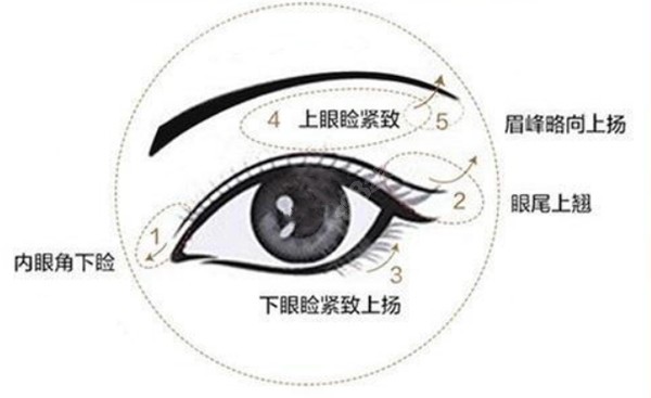 医生做的双眼皮修复手术