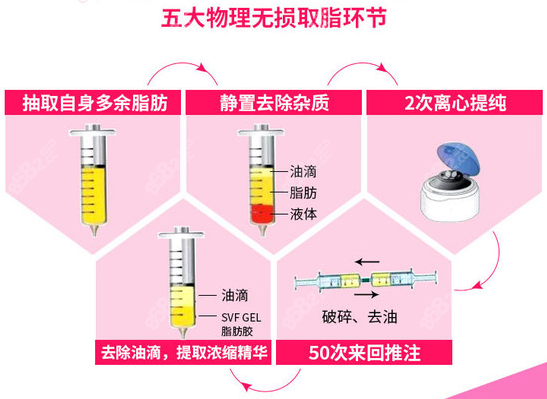 物理方法无损取脂图解