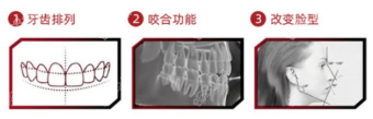 南京牙博士牙齿矫正可改善问题