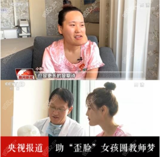 央视报道：沈阳杏林整形医院给歪脸女孩整容后的图片