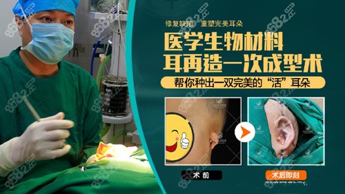 生物支架可一次成型