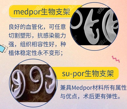 生物支架做耳再造的好处