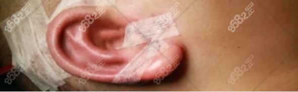 好看的耳垂