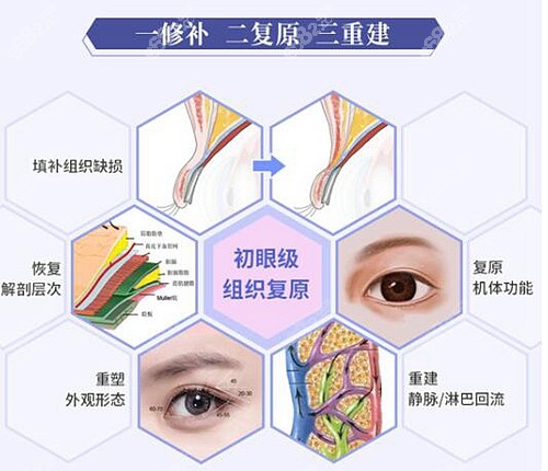 罗通贵修复双眼皮的优势