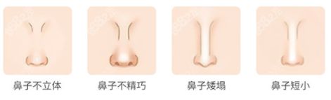 上海首尔丽格哪个医生做鼻子好呢？