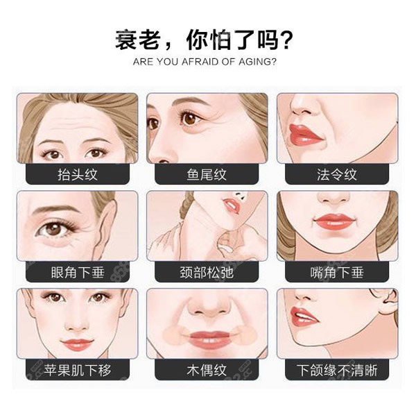面部提升手术适合哪些人做